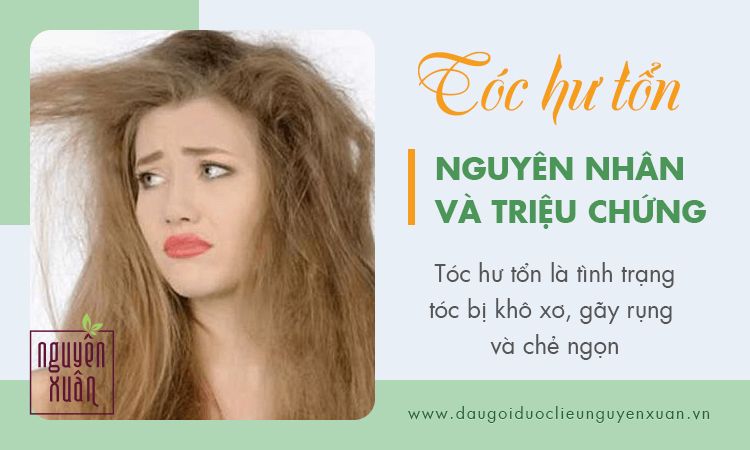 Mua Bộ sản phẩm chăm sóc tóc gãy rụng phục hồi hư tổn kích thích mọc tóc  cho cả nam và nữ ALIKA Platinum Tặng Mũ Trùm Tóc Ngẫu Nhiên tại TVC