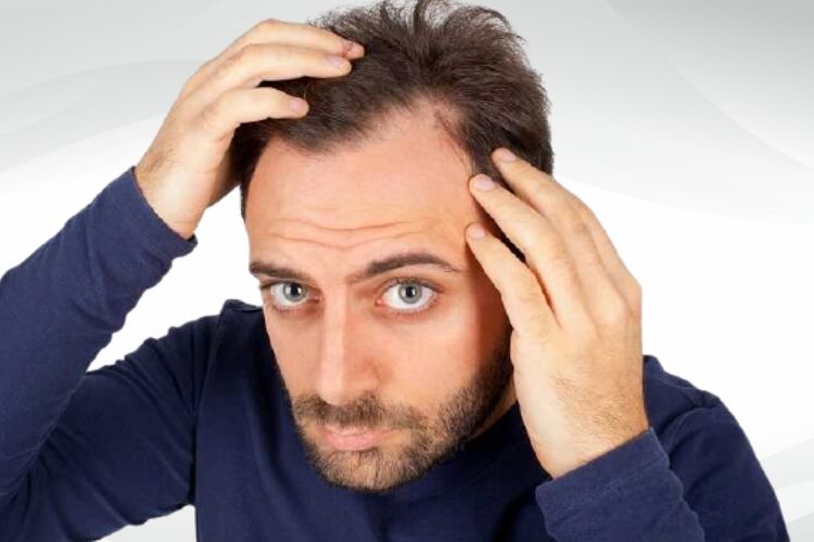 5 cách trị rụng tóc hói đầu đơn giản ngay tại nhà