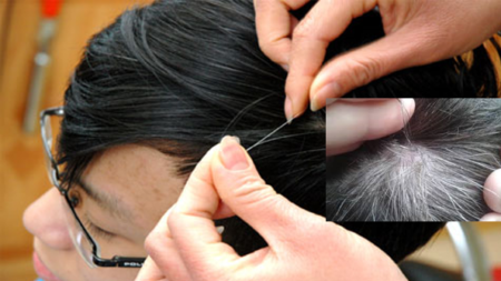 Çfarë e shkakton thinjjen e parakohshme të flokëve?